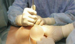 女人刮宫手术实拍视频,真实影像直击